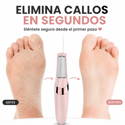 Lima Electri-Pro - AntiCallos