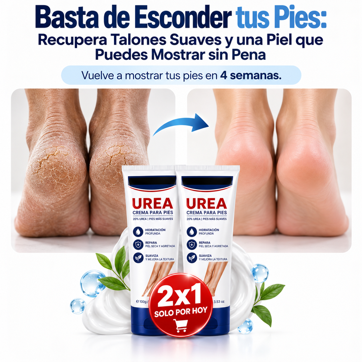 CREMA DE UREA ANTI CALLOS